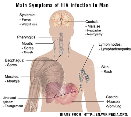 Main-Symptoms-of-HIV-infection-in-Man